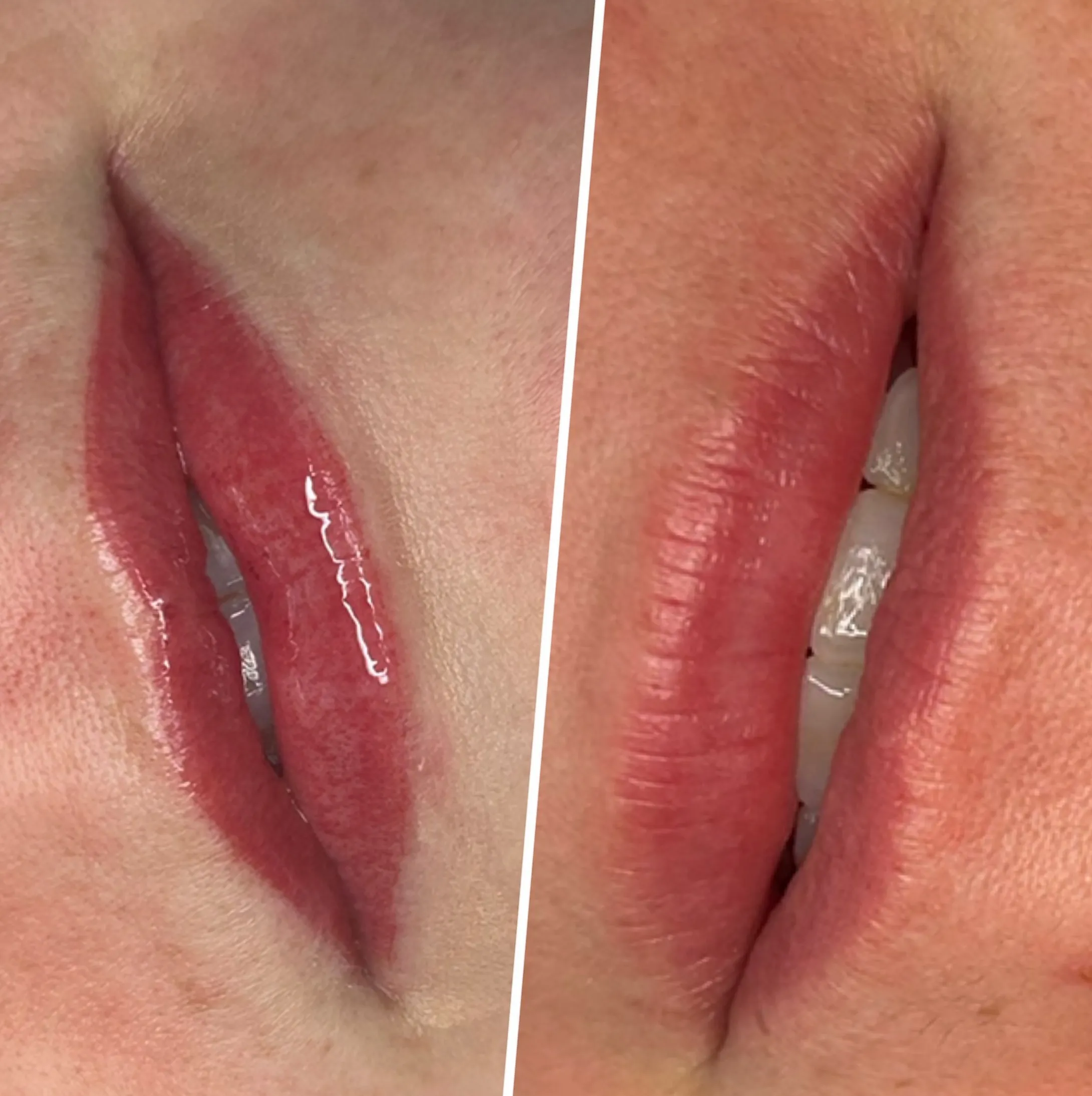 lip neutralisation before lip blush