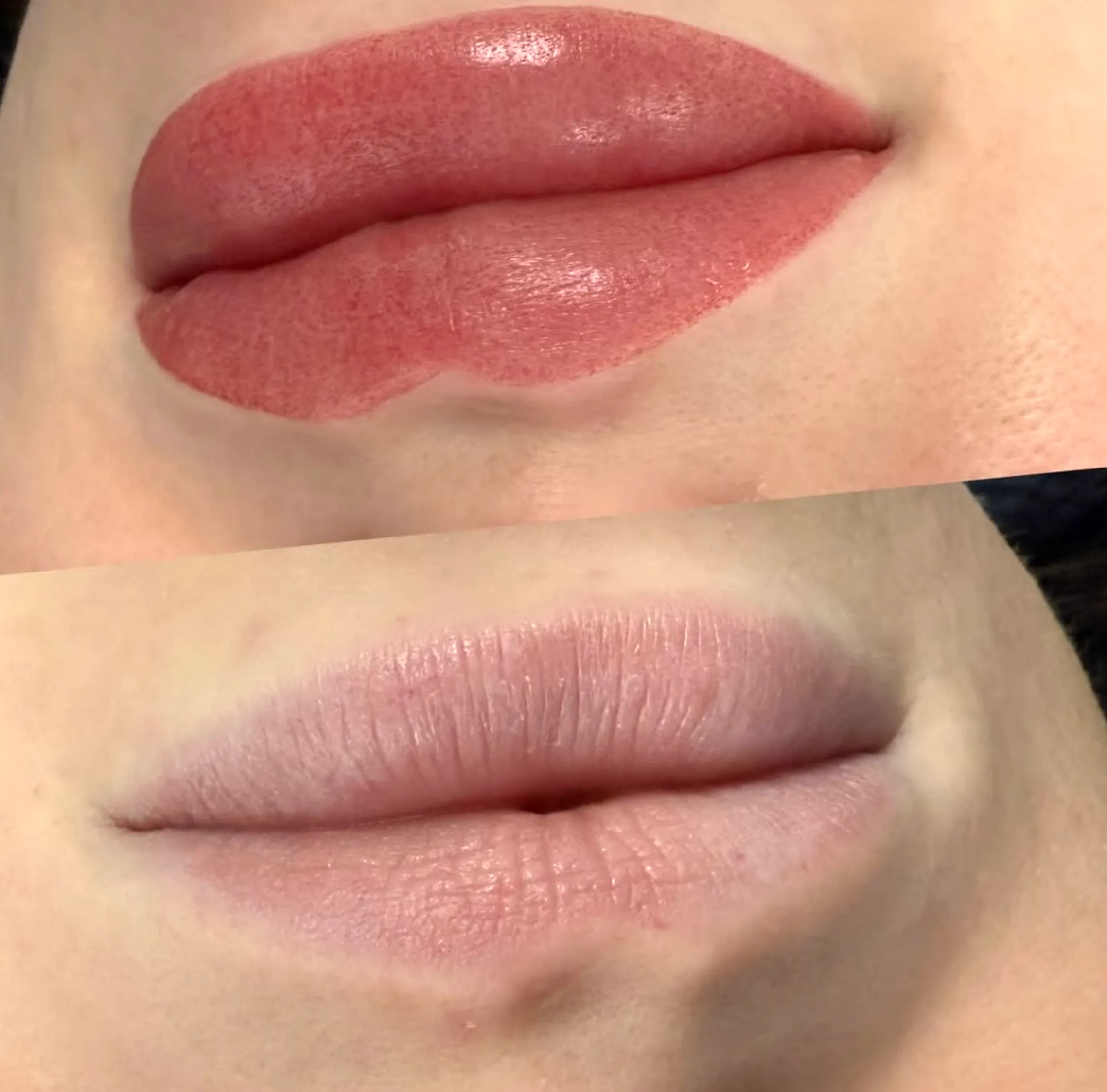 cosmetic lip tattoo Melbourne