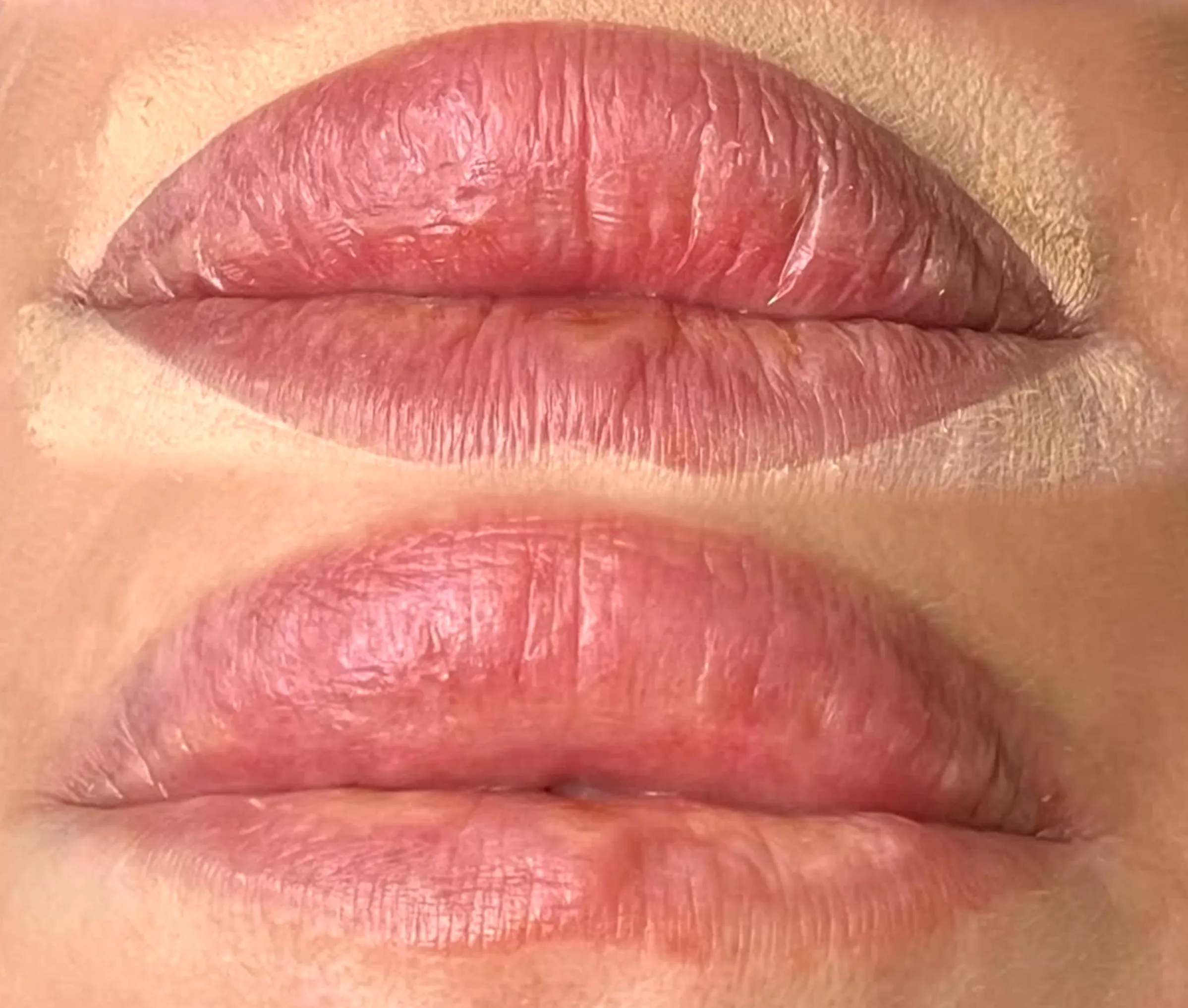 Does a Lip Tattoo Damage Lips?