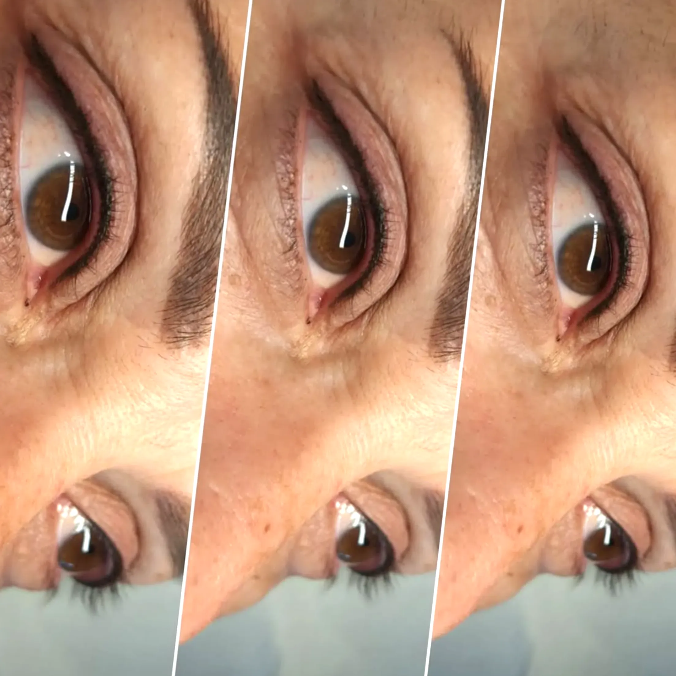 eyeliner tattoo lash loss