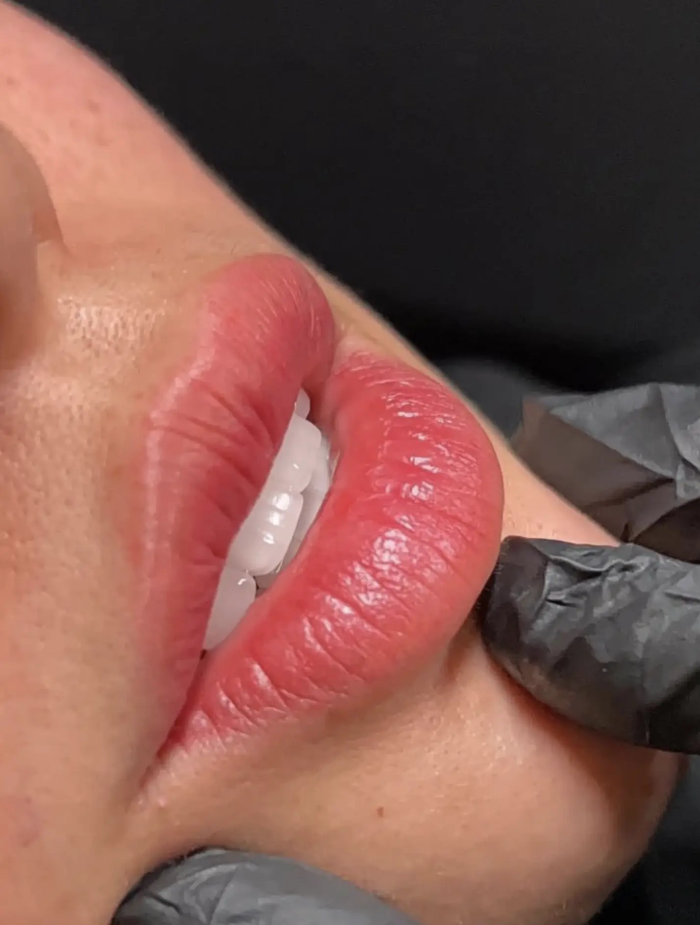 Microblading blade vs PMU device